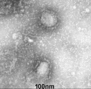 coronavirus al microscopio 2