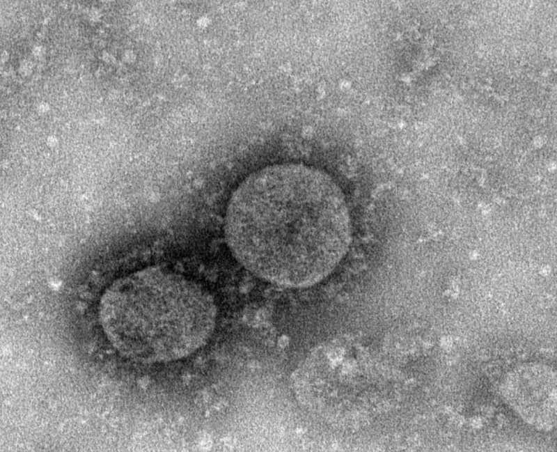 https://cdn-static.dagospia.com/img/foto/01-2020/coronavirus-al-microscopio-3-1270935.jpg