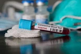 coronavirus sangue 1