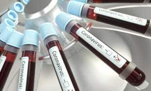 coronavirus sangue