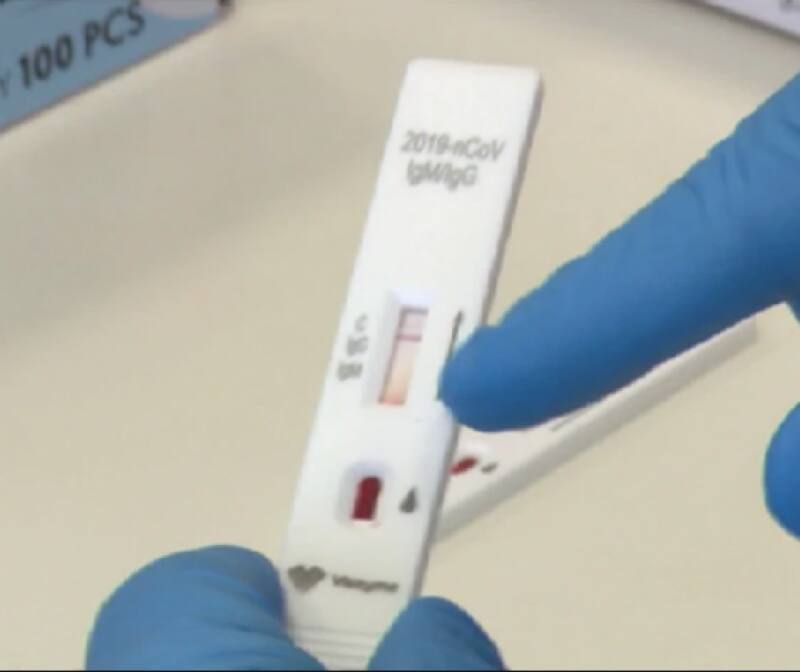 https://cdn-static.dagospia.com/img/foto/04-2020/test-sierologico-coronavirus-1-1303686.png