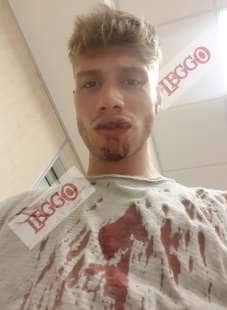 marco, il ragazzo massacrato di botte da un poliziotto a roma