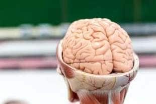  cervello 1